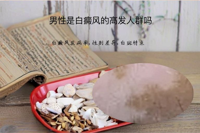 男性是白癜风的高发人群吗”