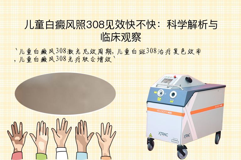 儿童白癜风照308见效快不快：科学解析与临床观察