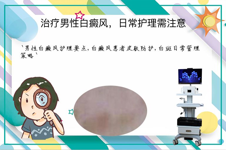 治疗男性白癜风，日常护理需注意
