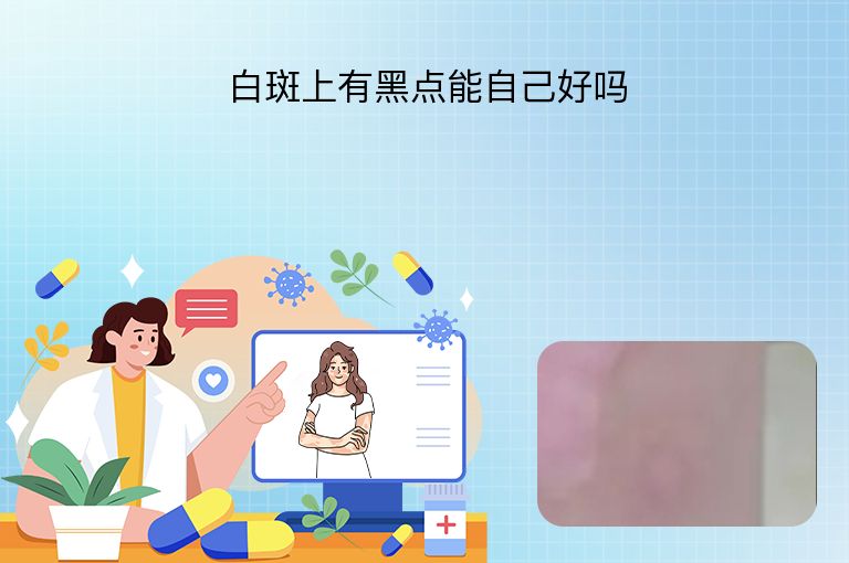 白斑上有黑点能自己好吗”