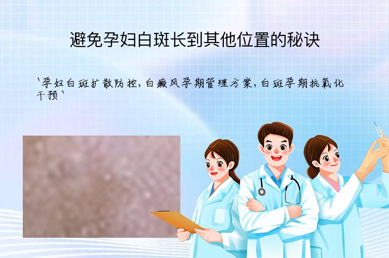 避免孕妇白斑长到其他位置的秘诀