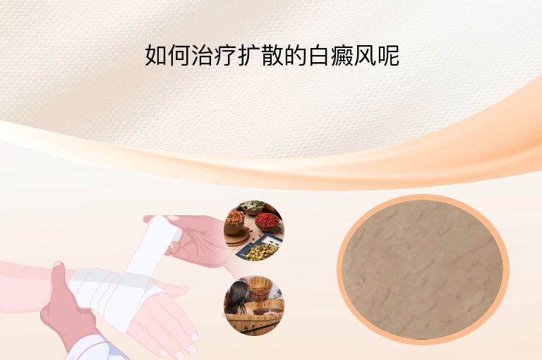 https://www.bdfsjzyy.com/d/file/p/74d1386589e0e5a3d862c544903d1a5b.jpeg