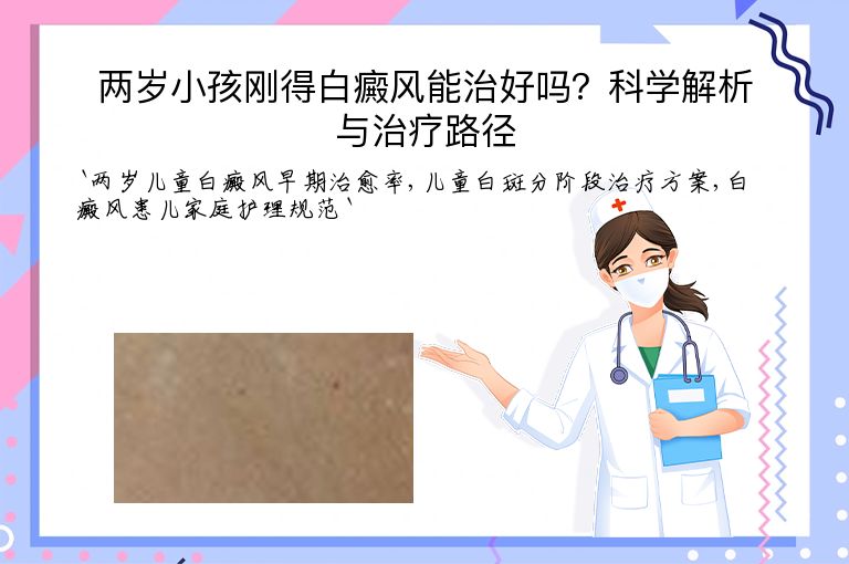 两岁小孩刚得白癜风能治好吗？科学解析与治疗路径”