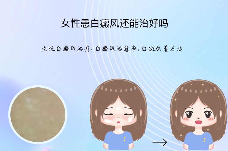 https://www.bdfsjzyy.com/d/file/p/548545a2738ac898a49421bddbc731f1.jpeg