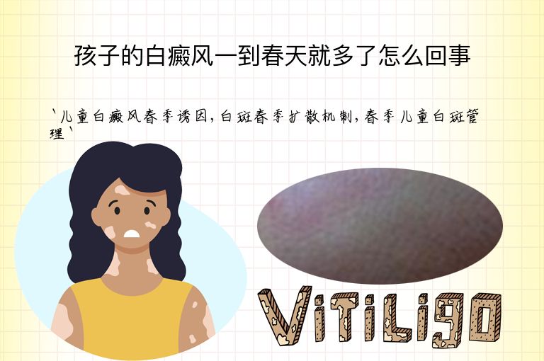 孩子的白癜风一到春天就多了怎么回事”