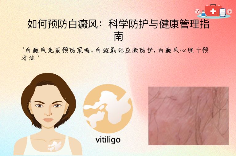 如何预防白癜风：科学防护与健康管理指南