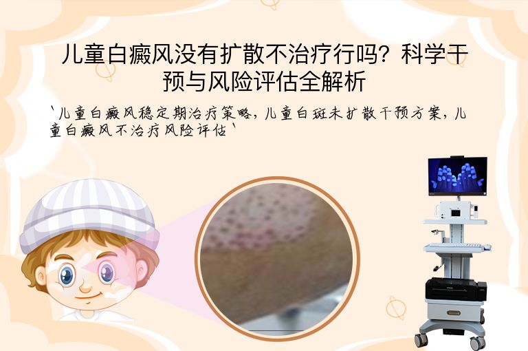 儿童白癜风没有扩散不治疗行吗？科学干预与风险评估全解析