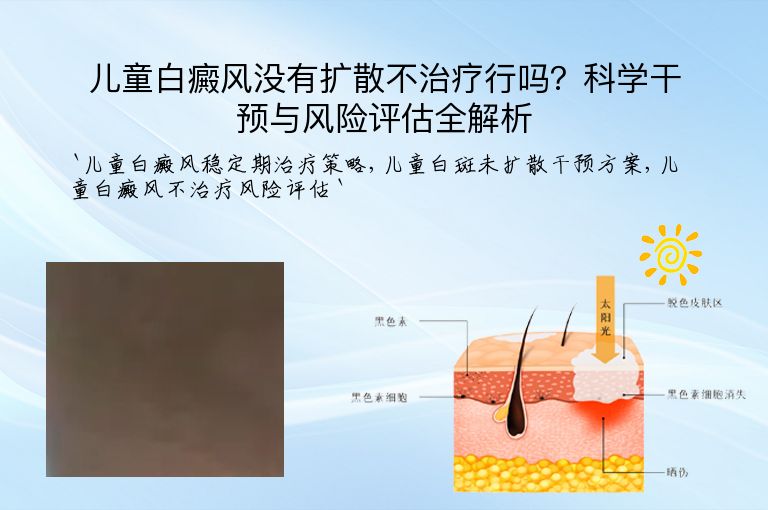 儿童白癜风没有扩散不治疗行吗?科学干预与风险评估全解析