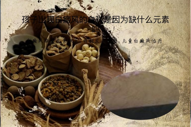 孩子出现白癜风的白斑是因为缺什么元素吗”
