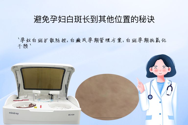 避免孕妇白斑长到其他位置的秘诀