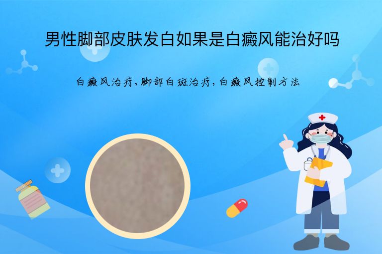男性脚部皮肤发白如果是白癜风能治好吗”