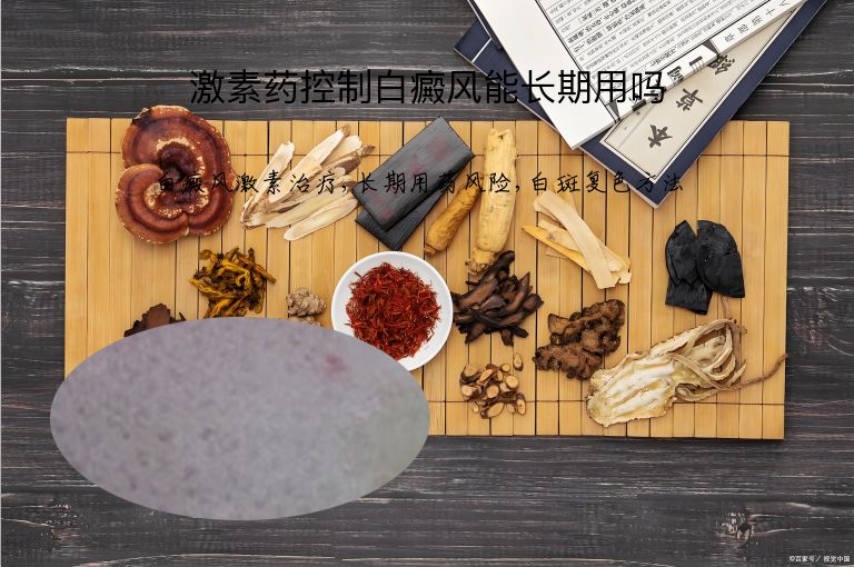 激素药控制白癜风能长期用吗”