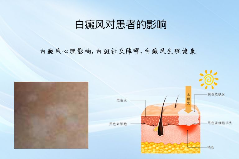 https://www.bdfsjzyy.com/d/file/p/c9dac46d1ec6ae24e7a970d3af41c16e.jpeg