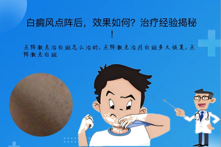 白癜风点阵后,效果如何?治疗经验揭秘!”