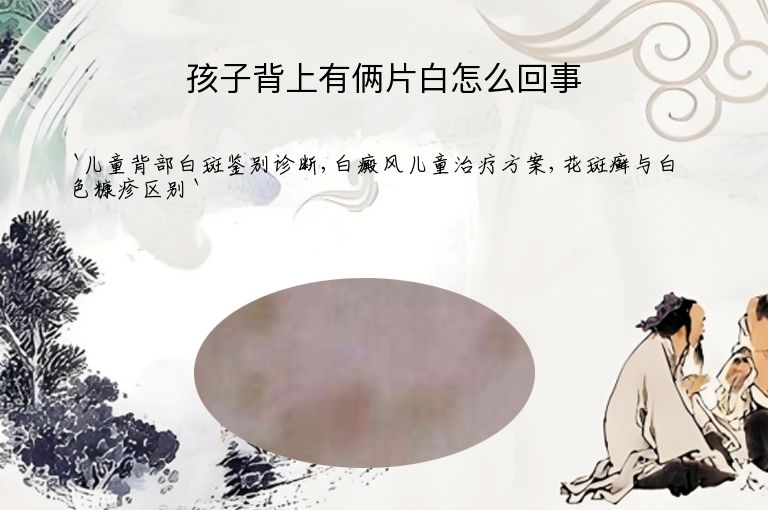 孩子背上有俩片白怎么回事