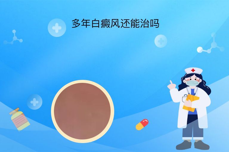 多年白癜风还能治吗”
