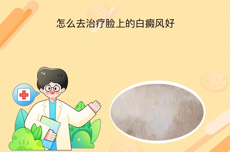 怎么去治疗脸上的白癜风好”