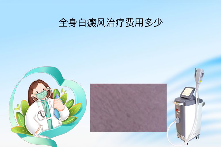 全身白癜风治疗费用多少”