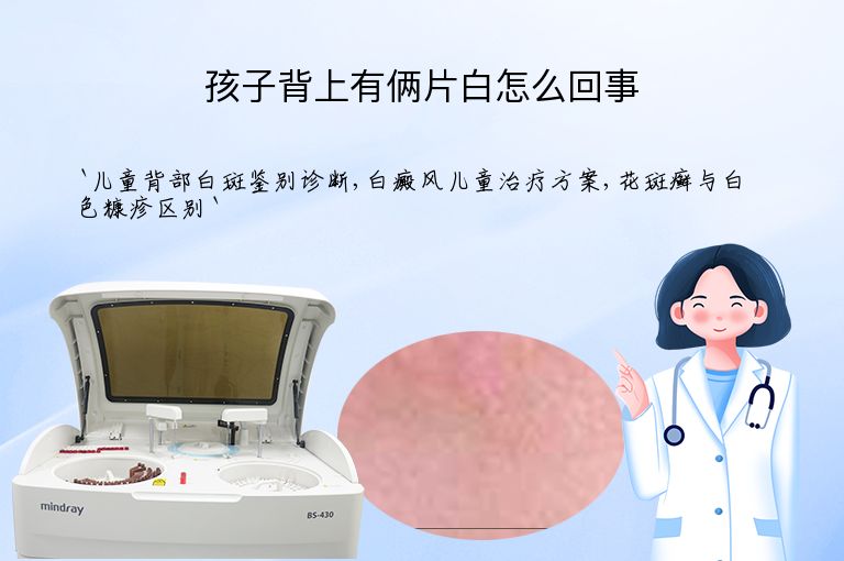 孩子背上有俩片白怎么回事