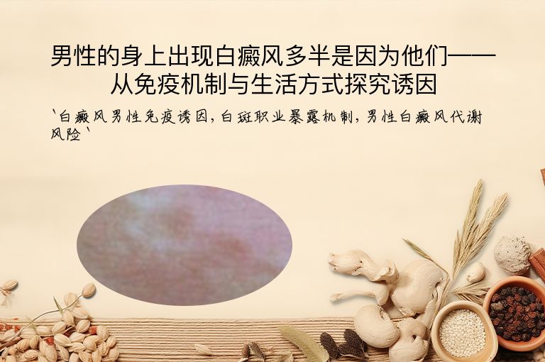 男性的身上出现白癜风多半是因为他们——从免疫机制与生活方式探究诱因