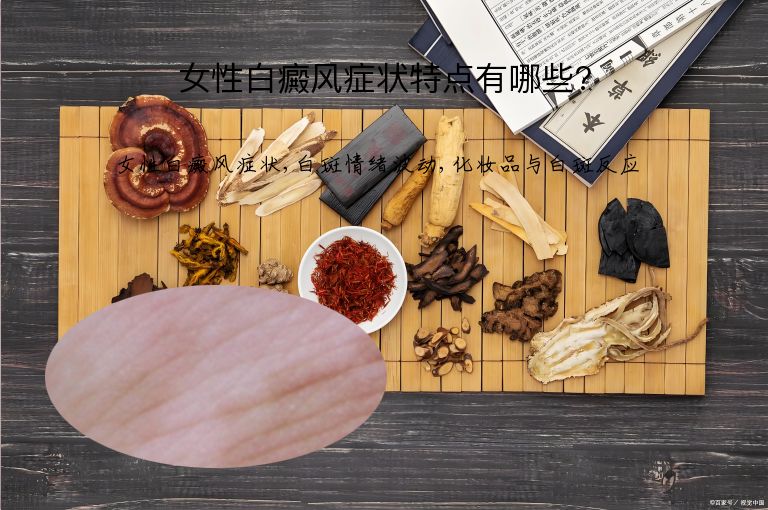 女性白癜风症状特点有哪些?”