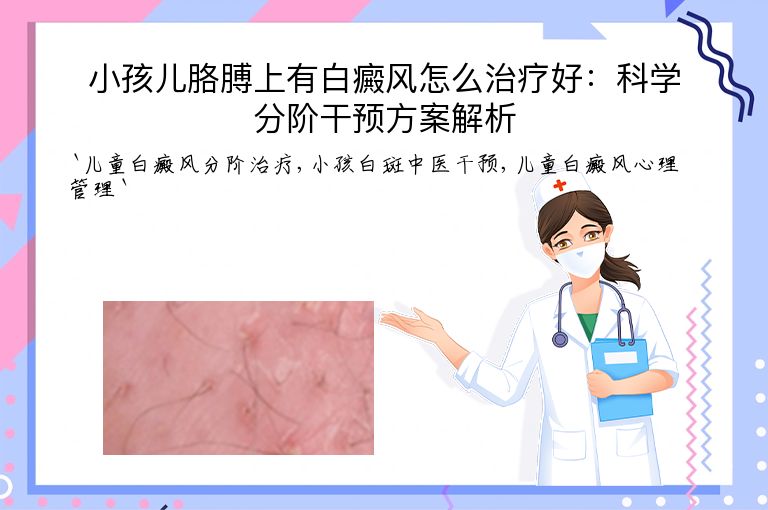 小孩儿胳膊上有白癜风怎么治疗好:科学分阶干预方案解析”