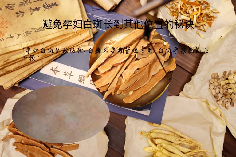 避免孕妇白斑长到其他位置的秘诀