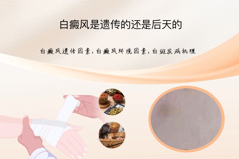 白癜风是遗传的还是后天的”