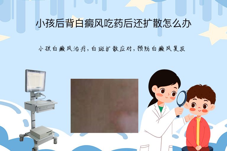 https://www.bdfsjzyy.com/d/file/p/0cbd61a503bbc15674617a0726a6bc53.jpeg