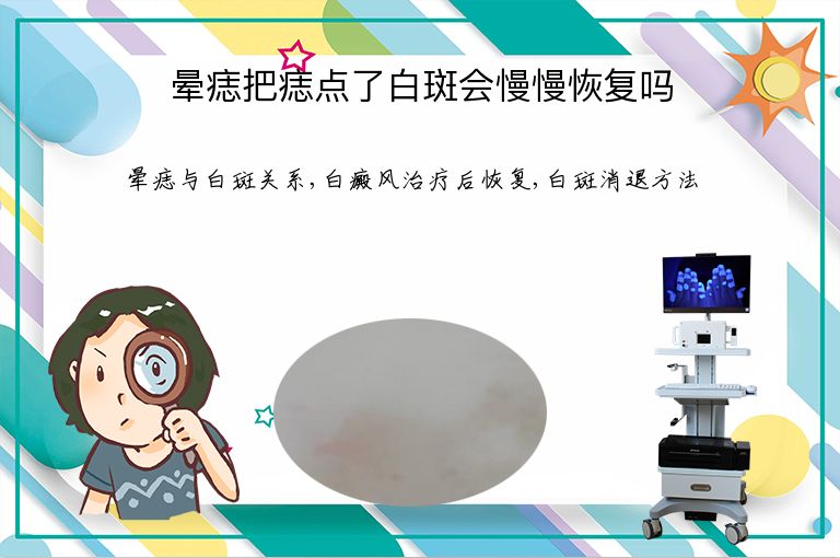 晕痣把痣点了白斑会慢慢恢复吗”