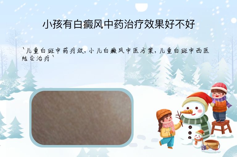 小孩有白癜风中药治疗效果好不好”