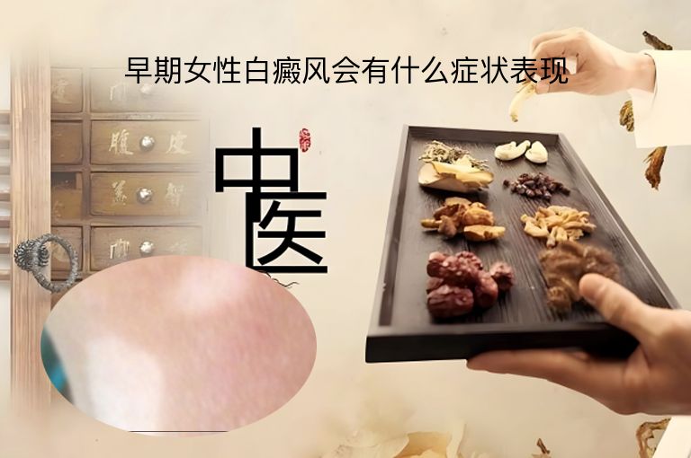 早期女性白癜风会有什么症状表现