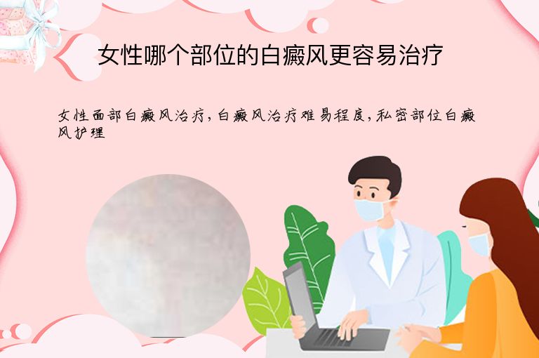 女性哪个部位的白癜风更容易治疗”
