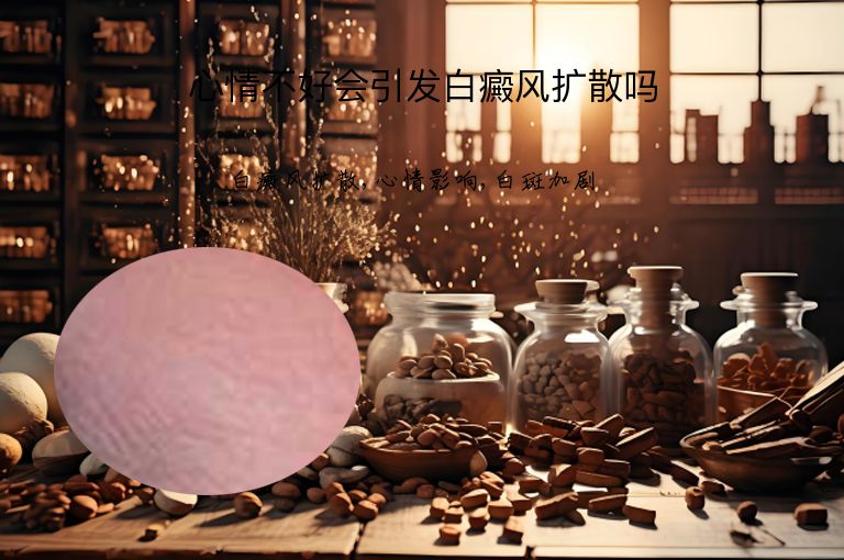 心情不好会引发白癜风扩散吗”