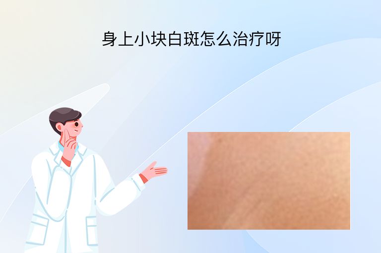 身上小块白斑怎么治疗呀”