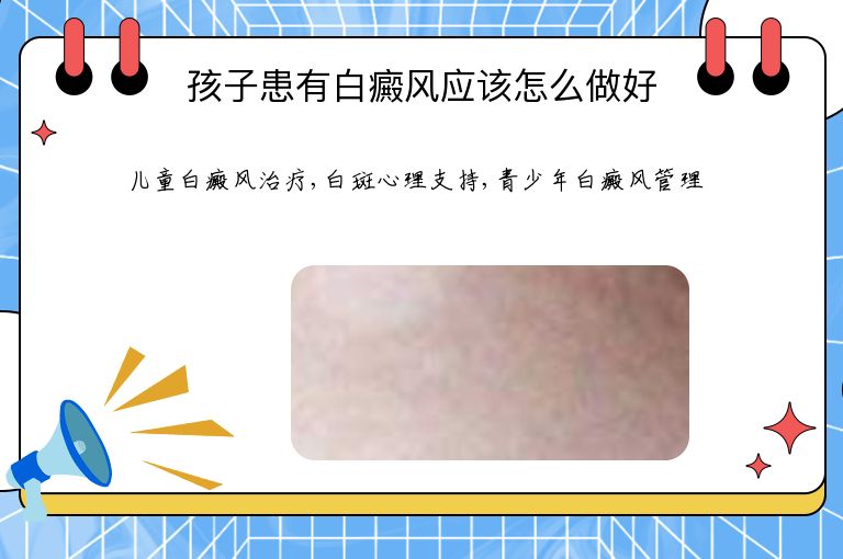 https://www.bdfsjzyy.com/d/file/p/908e2f9b6a477b707c7ac05ee5a056c2.jpeg