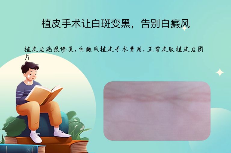 https://www.bdfsjzyy.com/d/file/p/c7cecbc5f031b4edb6a8e4d4246e3941.jpeg