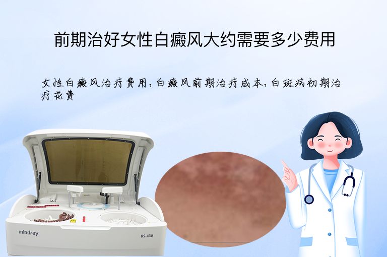 前期治好女性白癜风大约需要多少费用”