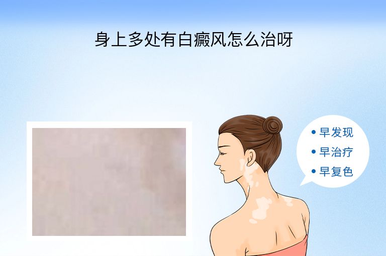 https://www.bdfsjzyy.com/d/file/p/c3d5457557a65e20ff6d43fe91f6d241.jpeg
