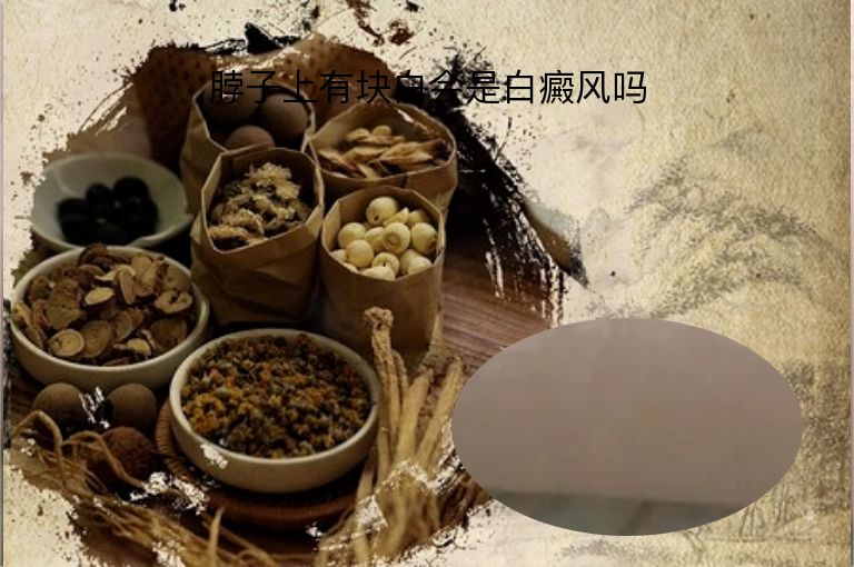 脖子上有块白会是白癜风吗