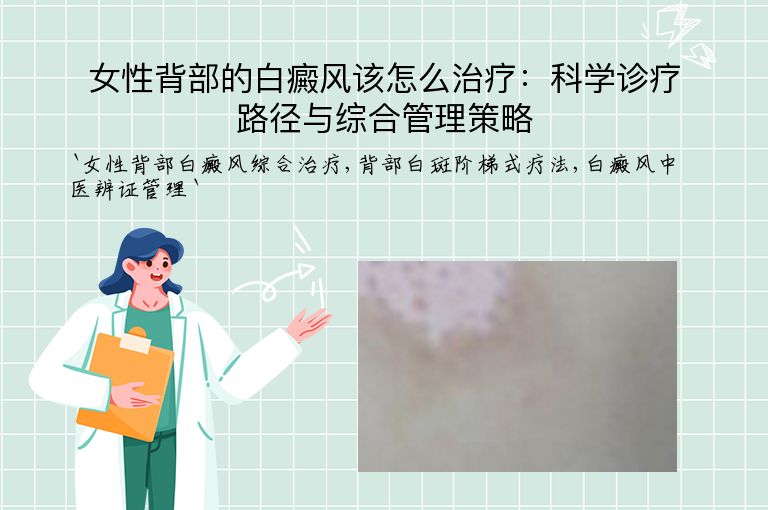 女性背部的白癜风该怎么治疗:科学诊疗路径与综合管理策略