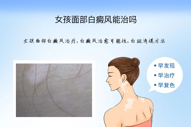 https://www.bdfsjzyy.com/d/file/p/00ad707923541455f7041af7e7c1a8fe.jpeg