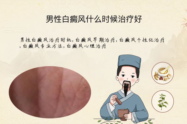 男性白癜风什么时候治疗好”