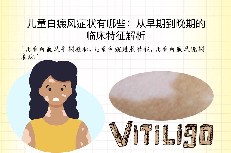 儿童白癜风症状有哪些：从早期到晚期的临床特征解析