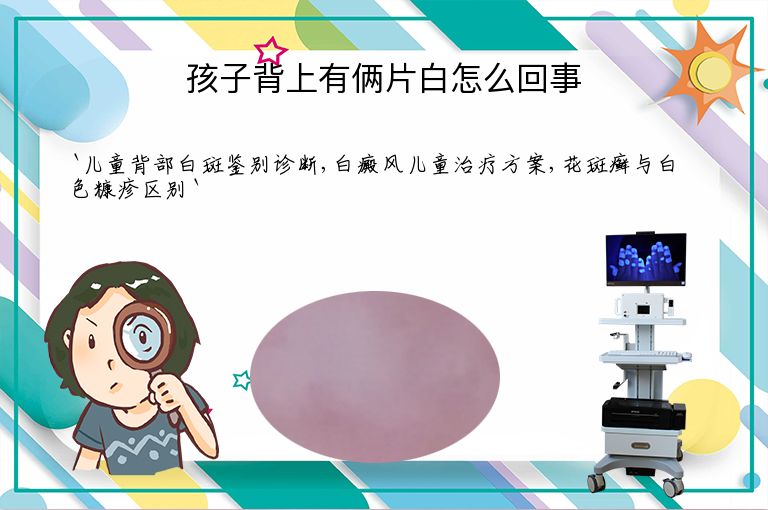 孩子背上有俩片白怎么回事