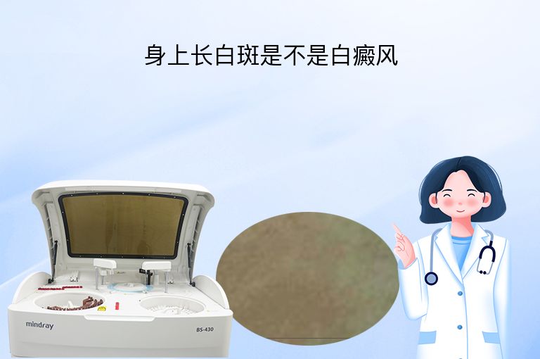 身上长白斑是不是白癜风