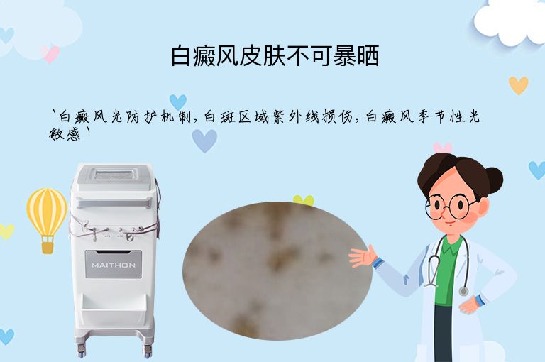 白癜风皮肤不可暴晒