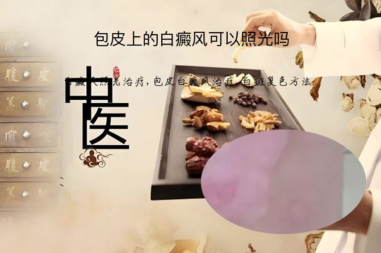 包皮上的白癜风可以照光吗”