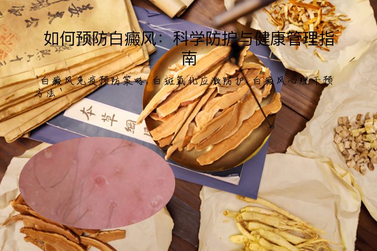 如何预防白癜风：科学防护与健康管理指南