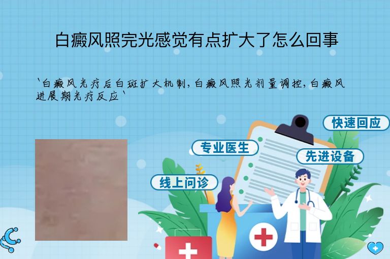 白癜风照完光感觉有点扩大了怎么回事”